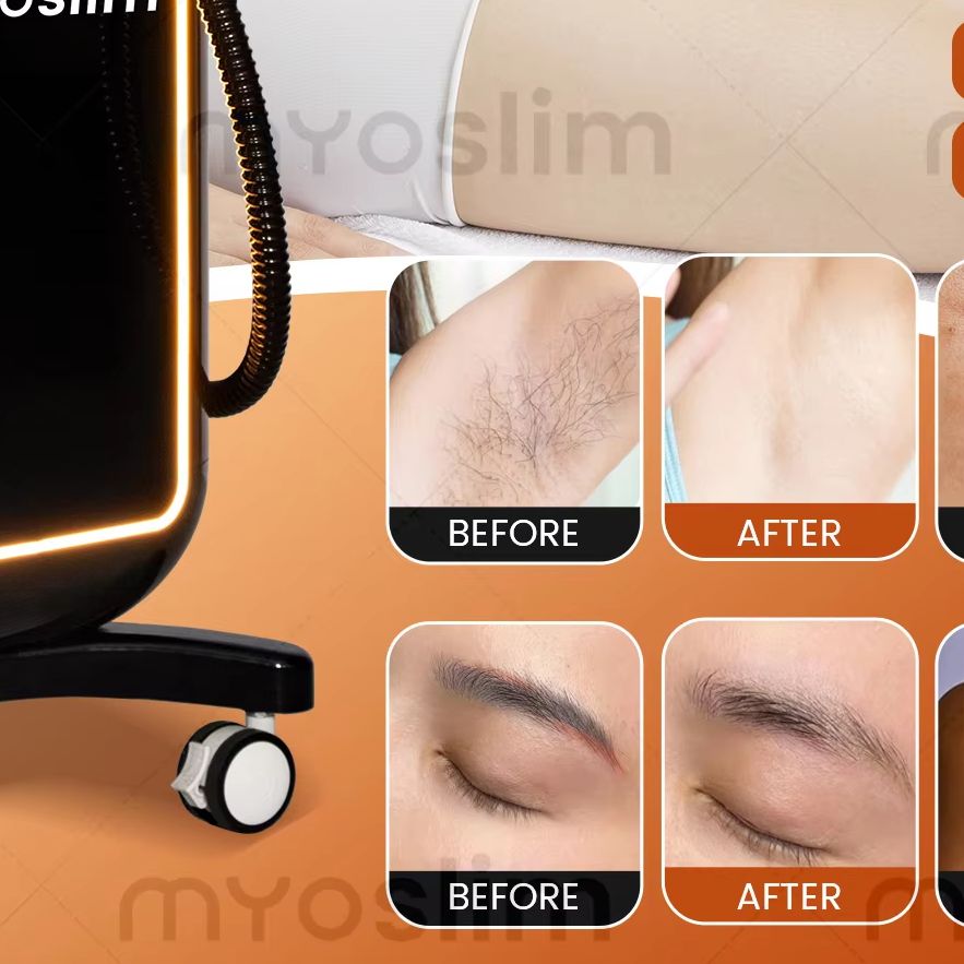 Hair Care Or Haircare - Multifunktionales 4-in-1 Diodenlaser-Haarentfernungsgerät, Pikosekunden-Tattooentfernung, RF-IPL-Akne-Hautpflege-Schönheitsgerät