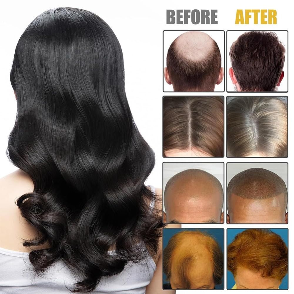 Neuer Haarwurzel-Pflegekamm mi – Hair Care Formulation Bewertung und Preis