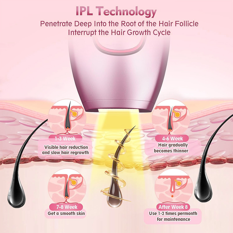 IPL Laser Haarentferner Haarsc – Hair Care Or Haircare Bewertung und Preis