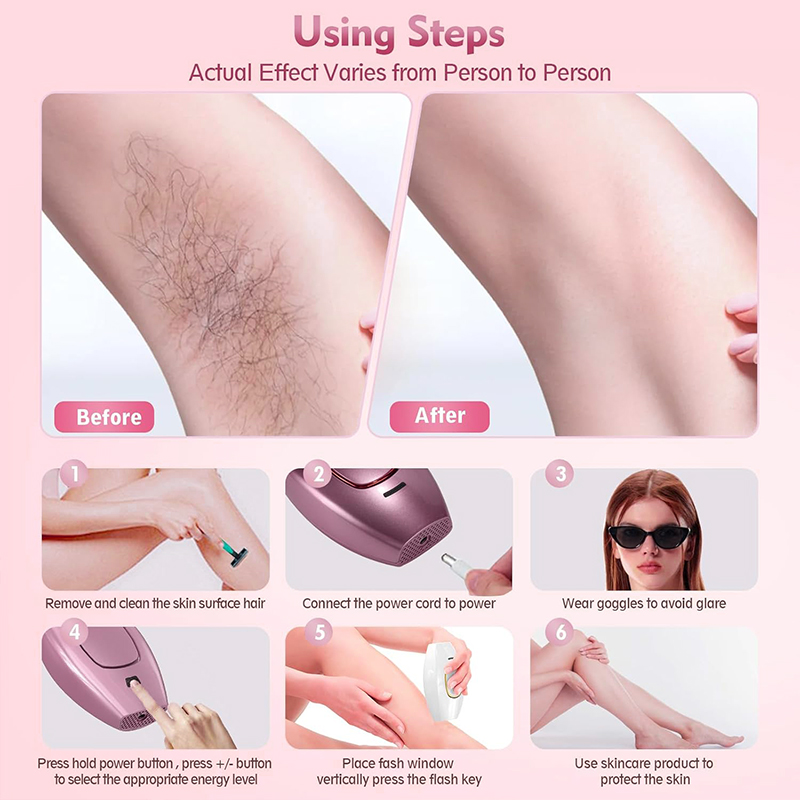 IPL Laser Haarentferner Haarsc – Hair Care Or Haircare Bewertung und Preis